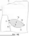 Fig. 35 - FLEXIBLE SURGICAL STENCILS AND RELATED METHODS