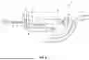 Fig. 05 - Automated Dental Drill