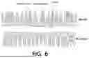 Fig. 06 - METHOD AND DEVICE FOR DESIGNING DENTAL RESTORATION