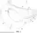 Fig. 03 - DENTAL DEVICE