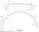Fig. 04 - DENTAL DEVICE