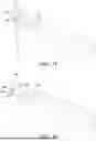 Fig. 17 - DENTAL DEVICE