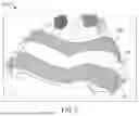 Fig. 03 - OPTIMIZED PATIENT-SPECIFIC DENTAL APPLIANCE DESIGN