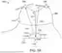 Fig. 06 - OPTIMIZED PATIENT-SPECIFIC DENTAL APPLIANCE DESIGN