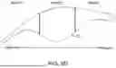 Fig. 09 - OPTIMIZED PATIENT-SPECIFIC DENTAL APPLIANCE DESIGN