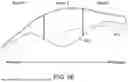Fig. 10 - OPTIMIZED PATIENT-SPECIFIC DENTAL APPLIANCE DESIGN