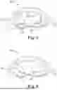 Fig. 06 - ARCH EXPANDING APPLIANCE