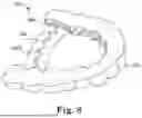 Fig. 08 - ARCH EXPANDING APPLIANCE