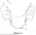 Fig. 03 - FORCE CONTROL, STOP MECHANISM, REGULATING STRUCTURE OF REMOVABLE ARCH ADJUSTMENT APPLIANCE