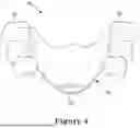 Fig. 05 - FORCE CONTROL, STOP MECHANISM, REGULATING STRUCTURE OF REMOVABLE ARCH ADJUSTMENT APPLIANCE