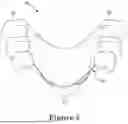 Fig. 06 - FORCE CONTROL, STOP MECHANISM, REGULATING STRUCTURE OF REMOVABLE ARCH ADJUSTMENT APPLIANCE