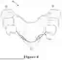Fig. 07 - FORCE CONTROL, STOP MECHANISM, REGULATING STRUCTURE OF REMOVABLE ARCH ADJUSTMENT APPLIANCE