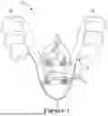 Fig. 08 - FORCE CONTROL, STOP MECHANISM, REGULATING STRUCTURE OF REMOVABLE ARCH ADJUSTMENT APPLIANCE