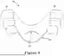 Fig. 10 - FORCE CONTROL, STOP MECHANISM, REGULATING STRUCTURE OF REMOVABLE ARCH ADJUSTMENT APPLIANCE
