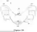Fig. 11 - FORCE CONTROL, STOP MECHANISM, REGULATING STRUCTURE OF REMOVABLE ARCH ADJUSTMENT APPLIANCE