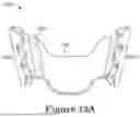 Fig. 14 - FORCE CONTROL, STOP MECHANISM, REGULATING STRUCTURE OF REMOVABLE ARCH ADJUSTMENT APPLIANCE