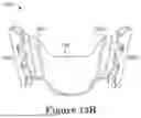 Fig. 15 - FORCE CONTROL, STOP MECHANISM, REGULATING STRUCTURE OF REMOVABLE ARCH ADJUSTMENT APPLIANCE