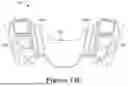 Fig. 16 - FORCE CONTROL, STOP MECHANISM, REGULATING STRUCTURE OF REMOVABLE ARCH ADJUSTMENT APPLIANCE