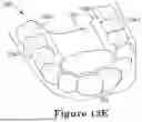 Fig. 18 - FORCE CONTROL, STOP MECHANISM, REGULATING STRUCTURE OF REMOVABLE ARCH ADJUSTMENT APPLIANCE