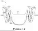 Fig. 19 - FORCE CONTROL, STOP MECHANISM, REGULATING STRUCTURE OF REMOVABLE ARCH ADJUSTMENT APPLIANCE