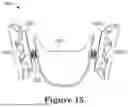 Fig. 20 - FORCE CONTROL, STOP MECHANISM, REGULATING STRUCTURE OF REMOVABLE ARCH ADJUSTMENT APPLIANCE