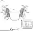Fig. 22 - FORCE CONTROL, STOP MECHANISM, REGULATING STRUCTURE OF REMOVABLE ARCH ADJUSTMENT APPLIANCE