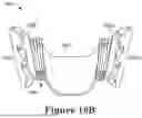 Fig. 24 - FORCE CONTROL, STOP MECHANISM, REGULATING STRUCTURE OF REMOVABLE ARCH ADJUSTMENT APPLIANCE