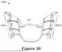 Fig. 26 - FORCE CONTROL, STOP MECHANISM, REGULATING STRUCTURE OF REMOVABLE ARCH ADJUSTMENT APPLIANCE