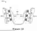 Fig. 28 - FORCE CONTROL, STOP MECHANISM, REGULATING STRUCTURE OF REMOVABLE ARCH ADJUSTMENT APPLIANCE