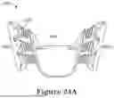 Fig. 30 - FORCE CONTROL, STOP MECHANISM, REGULATING STRUCTURE OF REMOVABLE ARCH ADJUSTMENT APPLIANCE