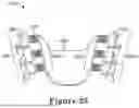 Fig. 32 - FORCE CONTROL, STOP MECHANISM, REGULATING STRUCTURE OF REMOVABLE ARCH ADJUSTMENT APPLIANCE