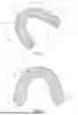 Fig. 02 - Dental Alveolar Prosthesis