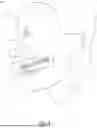 Fig. 04 - Dental Alveolar Prosthesis