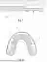 Fig. 05 - Dental Alveolar Prosthesis