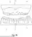 Fig. 08 - Dental Alveolar Prosthesis