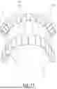 Fig. 09 - Dental Alveolar Prosthesis