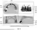 Fig. 07 - METHOD AND SYSTEM FOR DECOUPLING DENTAL ARCHES IN DENTAL SCAN DATA