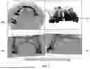 Fig. 08 - METHOD AND SYSTEM FOR DECOUPLING DENTAL ARCHES IN DENTAL SCAN DATA