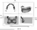 Fig. 09 - METHOD AND SYSTEM FOR DECOUPLING DENTAL ARCHES IN DENTAL SCAN DATA