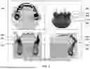 Fig. 10 - METHOD AND SYSTEM FOR DECOUPLING DENTAL ARCHES IN DENTAL SCAN DATA