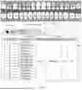 Fig. 07 - VIRTUAL DENTAL BRIDGE