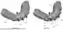 Fig. 10 - VIRTUAL DENTAL BRIDGE