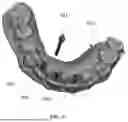 Fig. 11 - VIRTUAL DENTAL BRIDGE