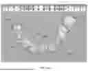Fig. 12 - VIRTUAL DENTAL BRIDGE