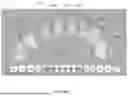 Fig. 13 - VIRTUAL DENTAL BRIDGE