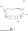 Fig. 02 - SPLIT DENTURE