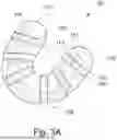 Fig. 04 - SPLIT DENTURE