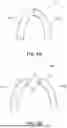 Fig. 06 - SPLIT DENTURE