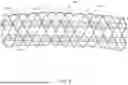 Fig. 06 - HOOK AND CROSS STENTS WITH IMPROVED CHARACTERISTICS
