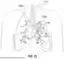 Fig. 15 - ROBOTIC SYSTEMS FOR DELIVERING ENDOBRONCHIAL IMPLANTS AND RELATED TECHNOLOGY